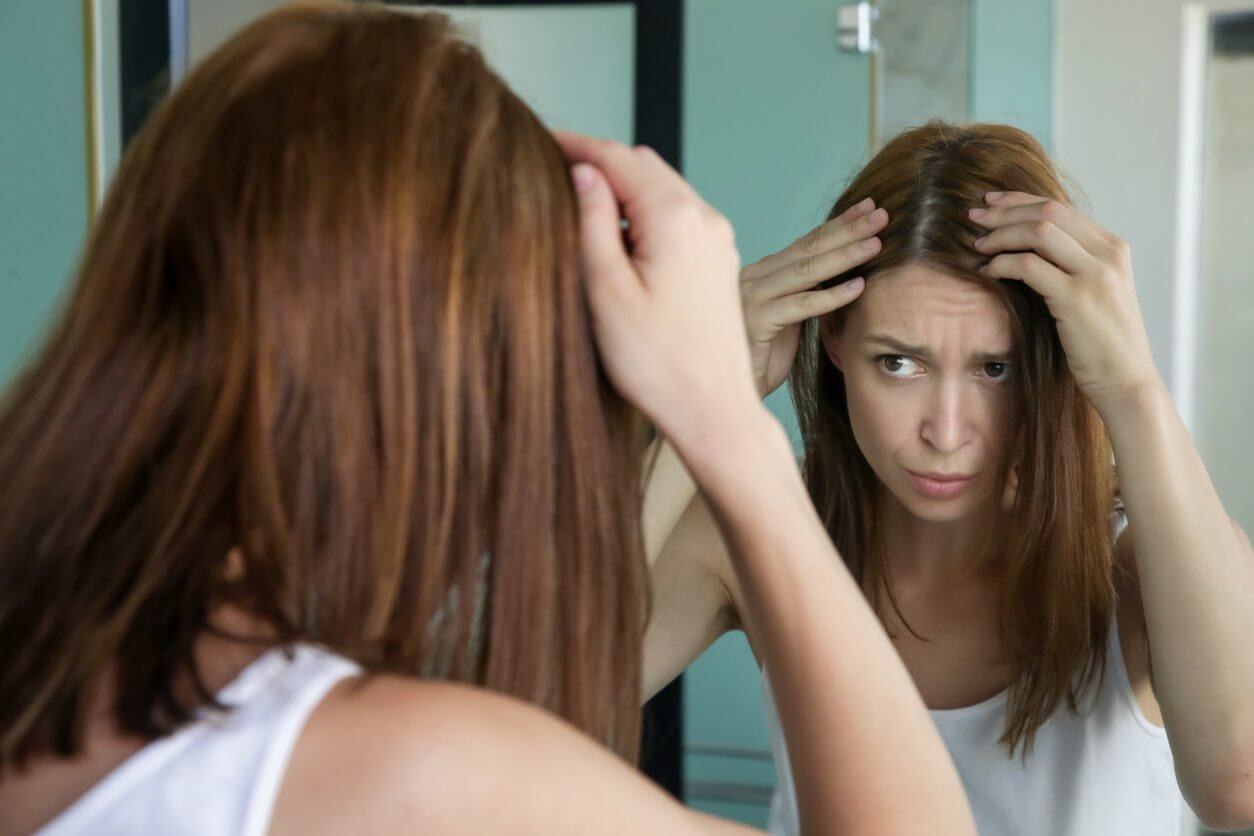 PCOS and hair loss